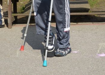 Le CHU de Toulouse généralise la télémédecine pour les soins orthopédiques