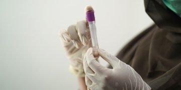 La 5e vague de Covid19 a atteint un pic ou un plateau estime le Conseil scientifique