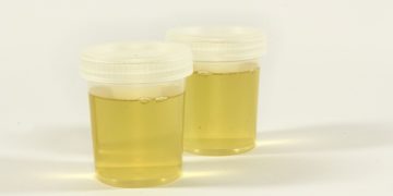 Maladies du Rein, journée de dépistage gratuit à Toulouse