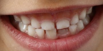 Les humains sont-ils les seuls à avoir des dents de lait ?