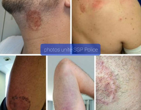 Tarbes 3 pompiers et 4 policiers roués de coups lors d'une intervention