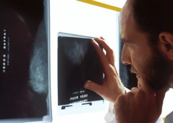 Le nombre de cancers va fortement augmenter de 77 % d'ici à 2050 selon l'OMS