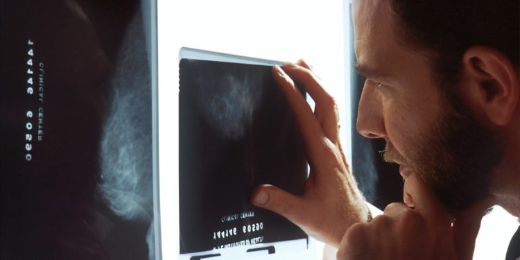 Le nombre de cancers va fortement augmenter de 77 % d'ici à 2050 selon l'OMS