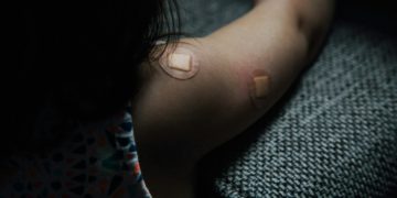 Mpox Variole du singe : les vaccins arrivent en République Démocratique du Congo