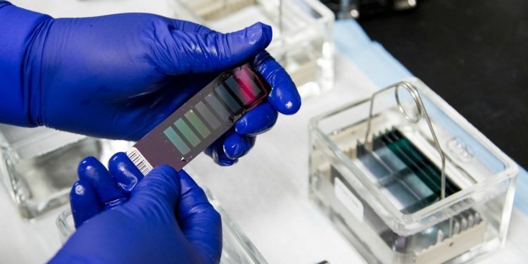 Un chercheur Toulousain perce le mystère d'un cancer qui touche 4000 personnes chaque année en France