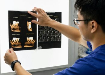Dentist examining dental x-rays on light board