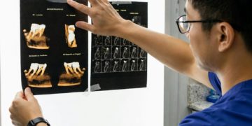 Dentist examining dental x-rays on light board