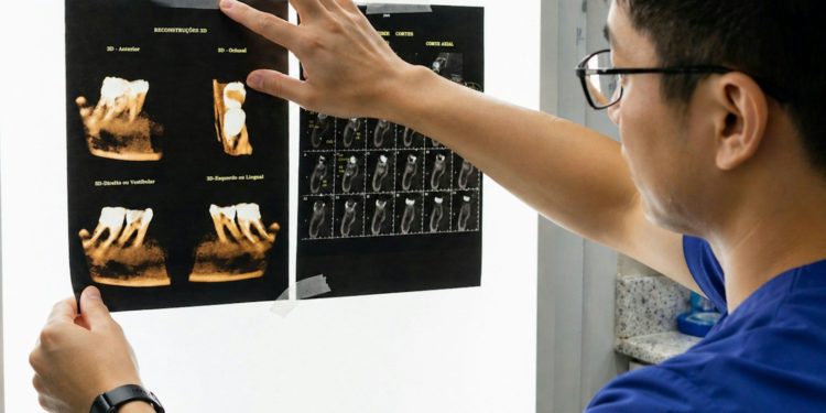 Dentist examining dental x-rays on light board