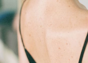 Les Kiné d'Occitanie mobilisés pour repérer les cancers de la peau